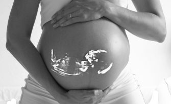 Birth injuries: Miscalculation of Fetus Size