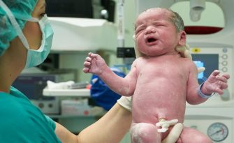 Suing a Midwife for Negligence